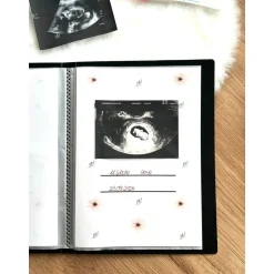 Personalisiertes Ultraschallbilder Album – Stabiles Einsteckalbum zur Aufbewahrung & Geschenkidee Fotoalbum & Gästebuch