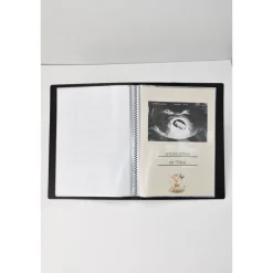 Hot Ultraschallalbum personalisiert,  zur Aufbewahrung von Ultraschallfotos, Ultraschallbilder Mappe, Geschenk zur Geburt Fotoalbum & Gästebuch
