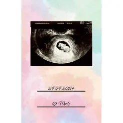 Clearance Ultraschallbilder Mappe Album für Ultraschallbilder personalisierbares Einsteckalbum stabiles Aufbewahrung Fotoalbum & Gästebuch