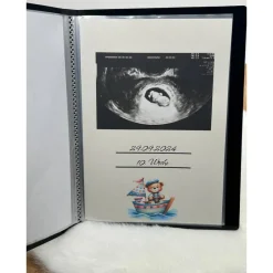 Outlet Ultraschallbilder Mappe Teddybär – personalisiertes Ultraschallalbum zur Aufbewahrung deiner Ultraschallbilder Fotoalbum & Gästebuch